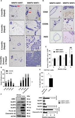 Macrophage IL-1β contributes to tumorigenesis through paracrine AIM2 inflammasome activation in the tumor microenvironment
